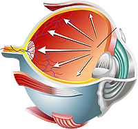 глаз при глаукоме
