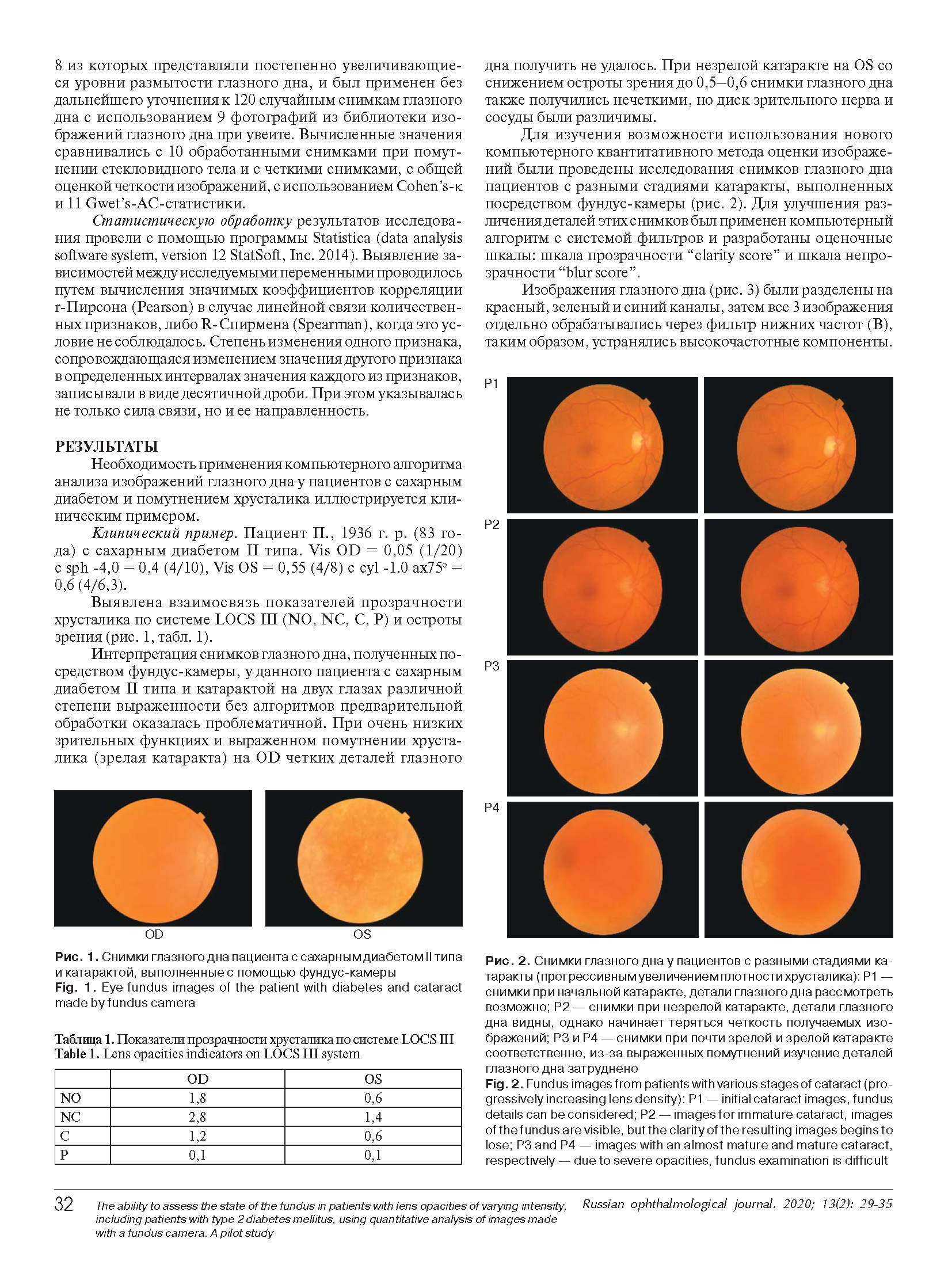 фундус-камера для оценки размытости глазного дна