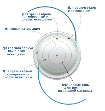 МУЛЬТИФОКАЛЬНЫЕ ИСКУССТВЕННЫЕ ХРУСТАЛИКИ