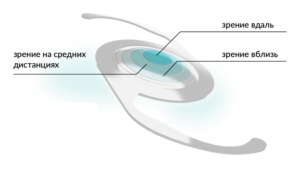 мультифокальный хрусталик