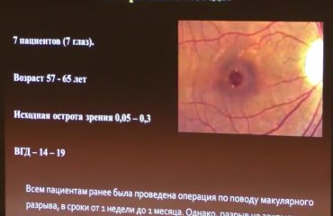 Видео доклада и "живая хирургия" профессора Кожухова А.А. с конференции 24-25 марта 2016 г.