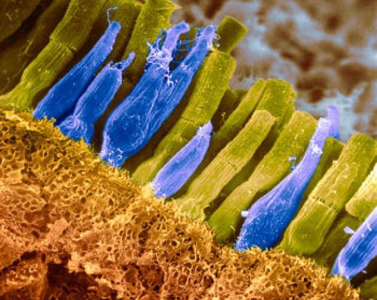 сетчатка под микроскопом